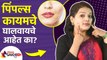 पिंपल्स पासून झटपट सुटका कशी मिळवायची | How to Remove Pimples Naturally | Home Remedies For Pimples