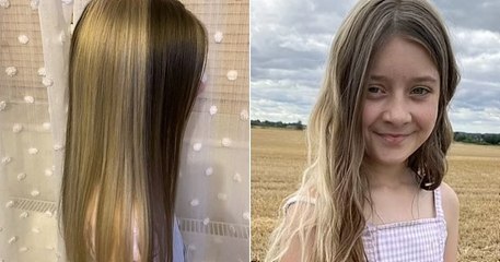 Âgée de 11 ans, cette jeune fille a des cheveux bicolores très rares provoqués par une tache de naissance