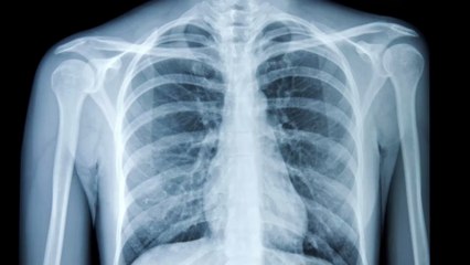 Bei einem Arztbesuch erfährt sie, dass ihr Herz am falschen Fleck sitzt