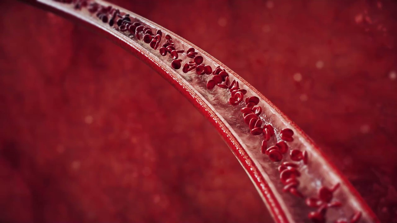 Mikroevolution beim Homo Sapiens: Bei immer mehr Menschen wird eine neue Arterie entdeckt