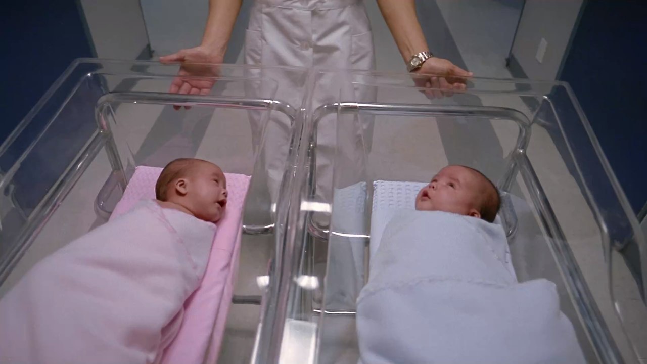 Gemeinsamer Hinterkopf: Siamesische Zwillinge können sich nach einem Jahr zum 1. Mal ansehen