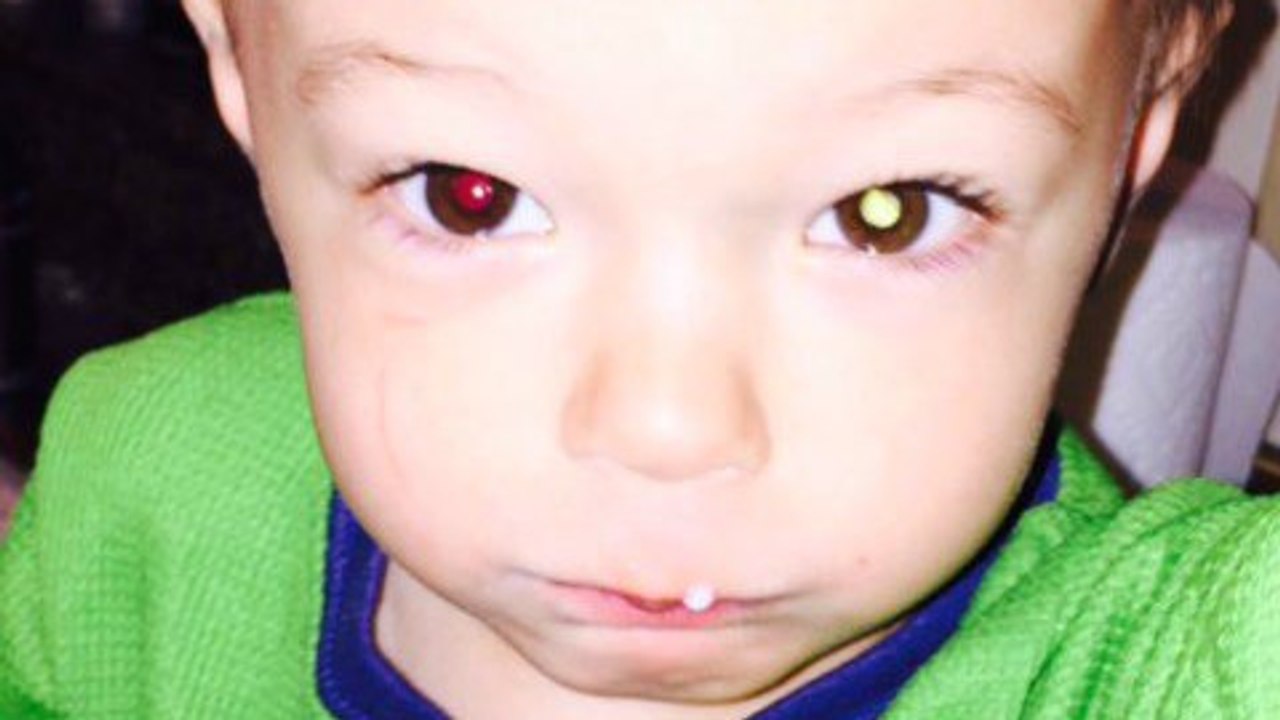 Une mère utilise un appareil photo pour détecter un cancer à son fils