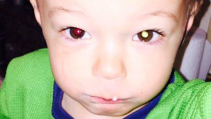 Une mère utilise un appareil photo pour détecter un cancer à son fils