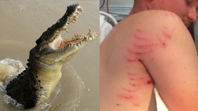 Attaqué par un crocodile, cet Australien survit grâce à un réflexe étonnant