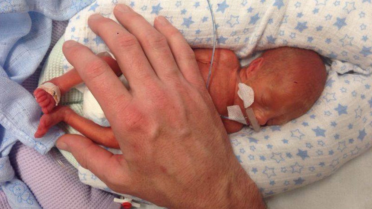 Les médecins pensaient que ce bébé allait mourir quand un miracle s'est produit