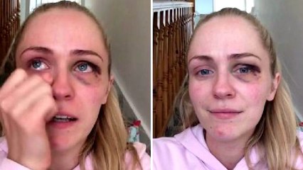 Une jeune femme victime de violences conjugales livre un témoignage bouleversant