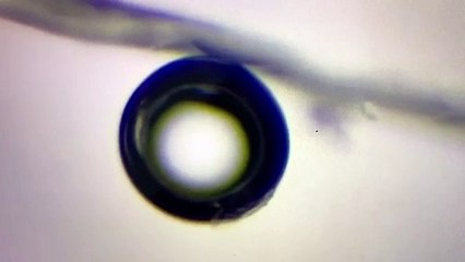 Grossissement 400-600x sur un microscope composé d'un organisme parasitaire