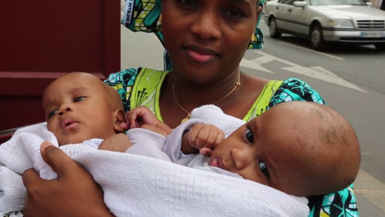 Des bébés siamois séparés avec succès à Paris