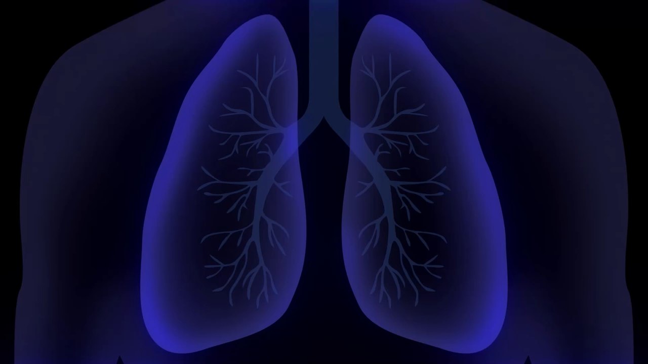Parallelen zur Lungenfibrose: Studie erklärt, warum Covid-Patient:innen so lange beatmet werden müssen