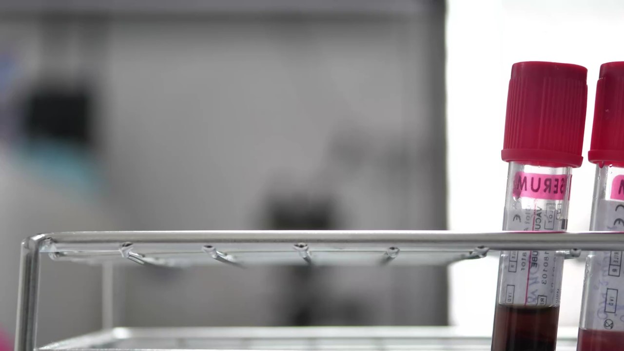 Hoffnung aus der Krebsforschung: Ein neuer Bluttest erkennt sofort Krebs und Metastasenbildung