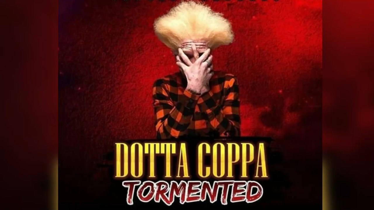 Vom Mobbingopfer zum Werbestar: Albino-Model startet durch