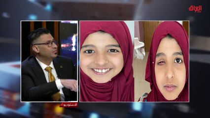 مختص في العيون الاصطناعية يحدثنا عن هذا المجال الطبي المميز