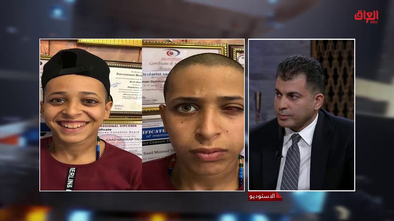 زراعة  العين البشرية وإمكانية ذلك مع اختصاصي طب وجراحة العيون