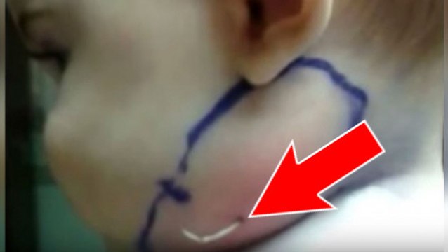 Un médecin fait une découverte très étrange dans le cou d'un bébé