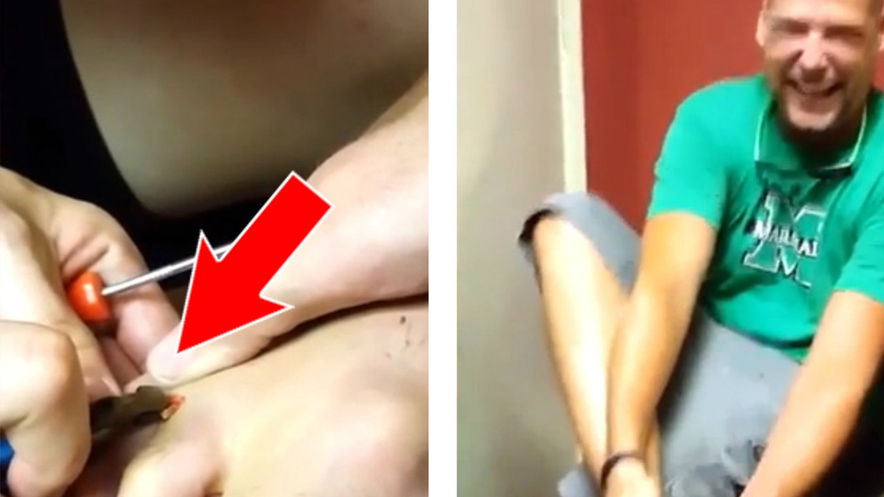 Il se plaignait d'une douleur au pied et on lui retire une écharde de plusieurs centimètres. Impressionnant !