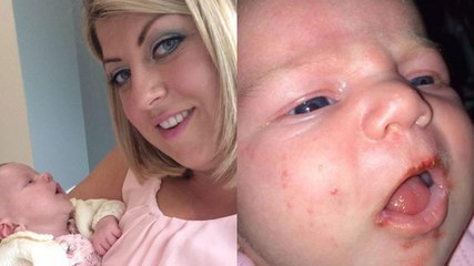 Son bébé frôle la mort après avoir été embrassé par un proche