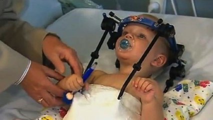 Le miracle de Jackson : décapité lors d'un accident, il survit grâce à l'intervention des médecins