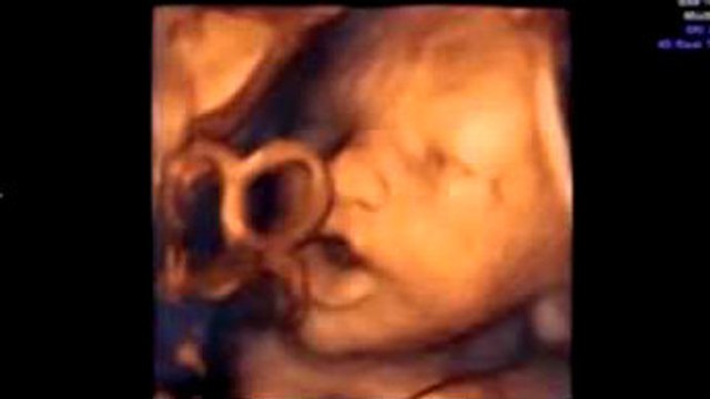 Un bébé chante dans le ventre de sa maman en entendant du Mozart