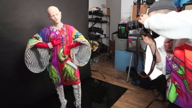 Ce mannequin atteint d'une rare maladie génétique crée la sensation sur internet