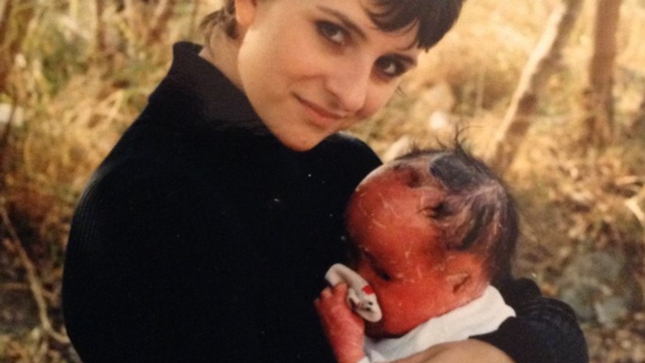 Appelée l'enfant Harlequin, Mui Thomas est atteinte d'une maladie de peau extrêmement rare