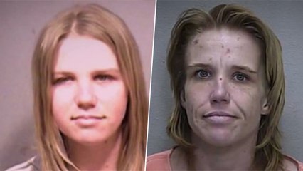 Prévention : une association dévoile des avant-après choquants de personnes droguées