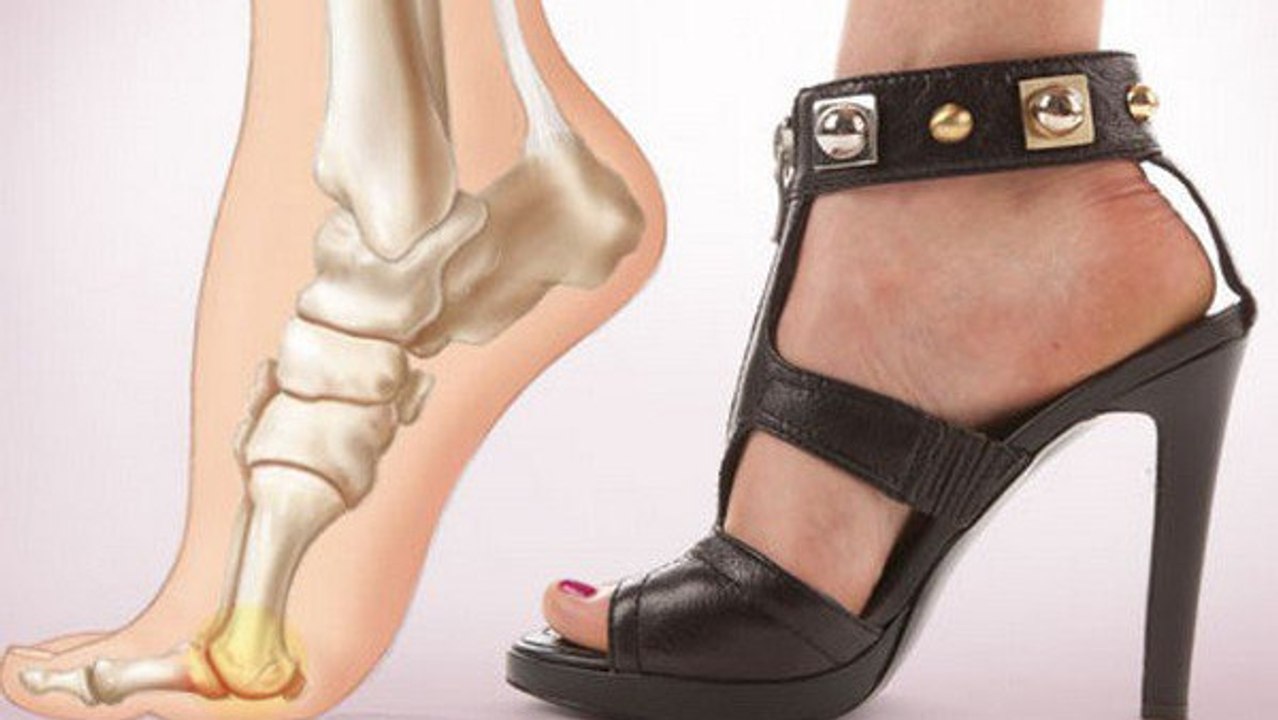 Voici pourquoi les talons hauts sont dangereux pour la santé