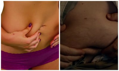 Découvrez les complexes les plus détestés des français