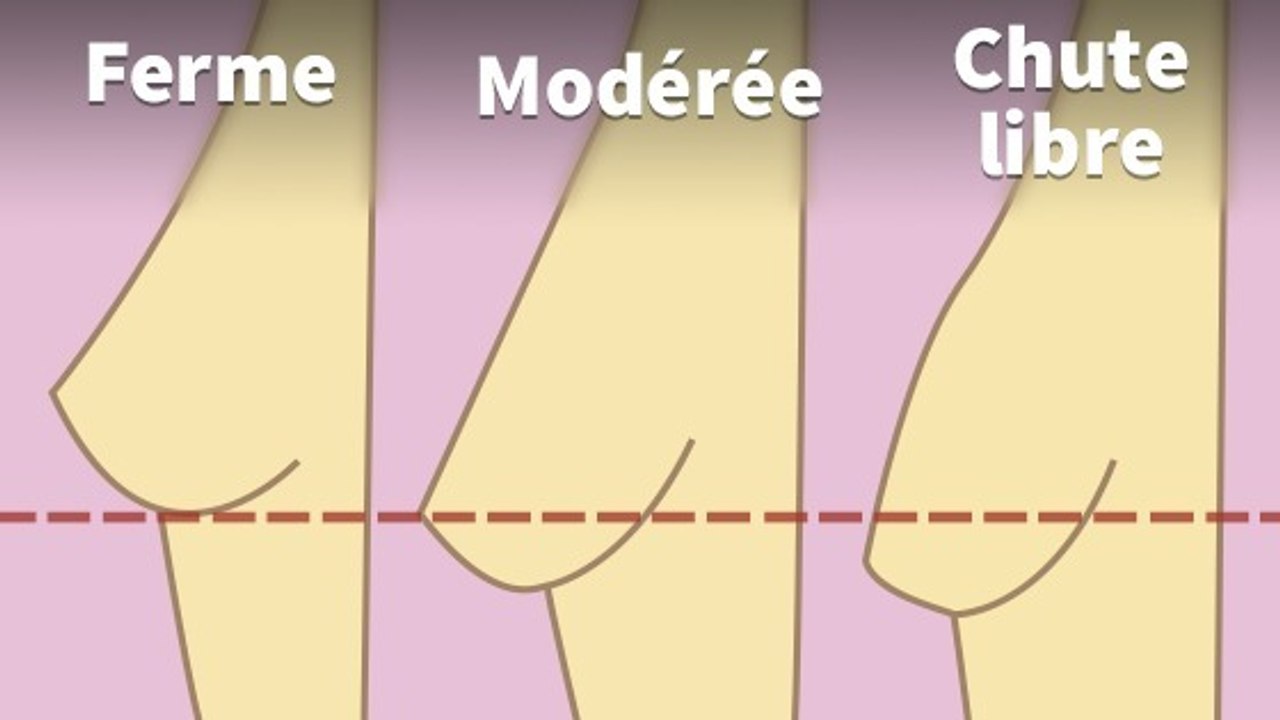 Top 5 des solutions miracles avoir une poitrine plus ferme