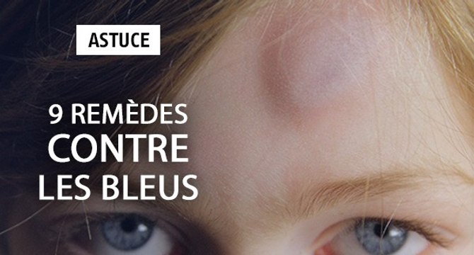 9 remèdes contre les bleus
