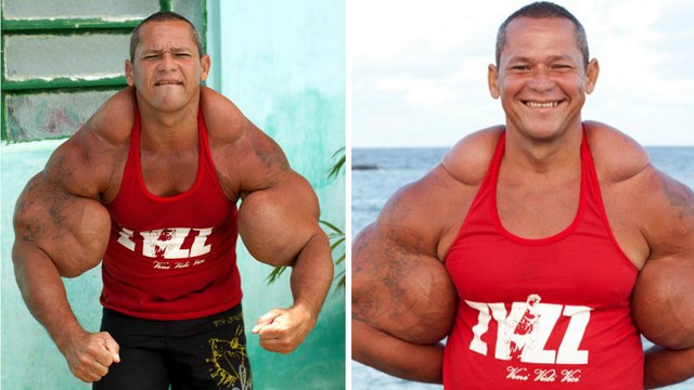 Arlindo de Souza : les faux muscles de ce Brésilien créent la polémique