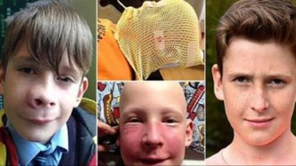 Ce garçon croit avoit été piqué par un moustique... Cela cachait quelque chose de bien plus grave !