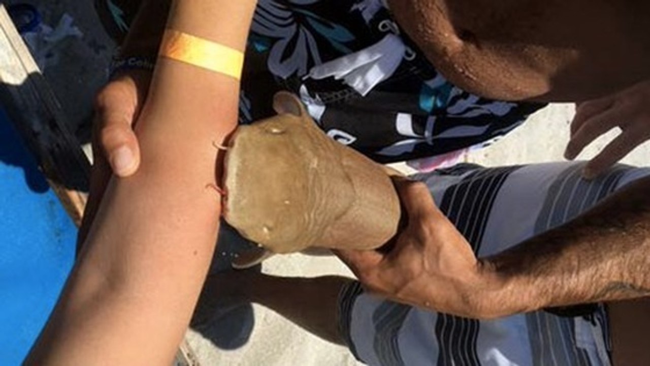 Mordue dans l'eau, une nageuse est hospitalisée avec un requin accroché au bras