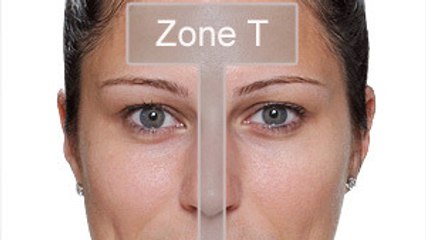 L'incroyable astuce pour dégommer l'excès de sébum sur la zone T
