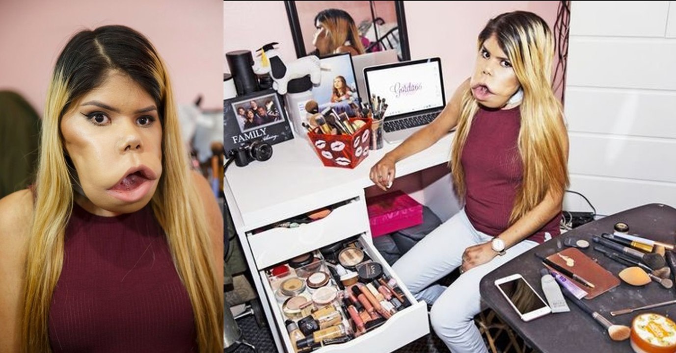 Marimar Quiroa : la youtubeuse atteinte d'une tumeur au visage qui casse les diktats de la beauté