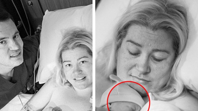 Kate Hill : Victime du syndrome d'ovaires polykystiques, elle tombe enceinte deux fois en l'espace de 10 jours