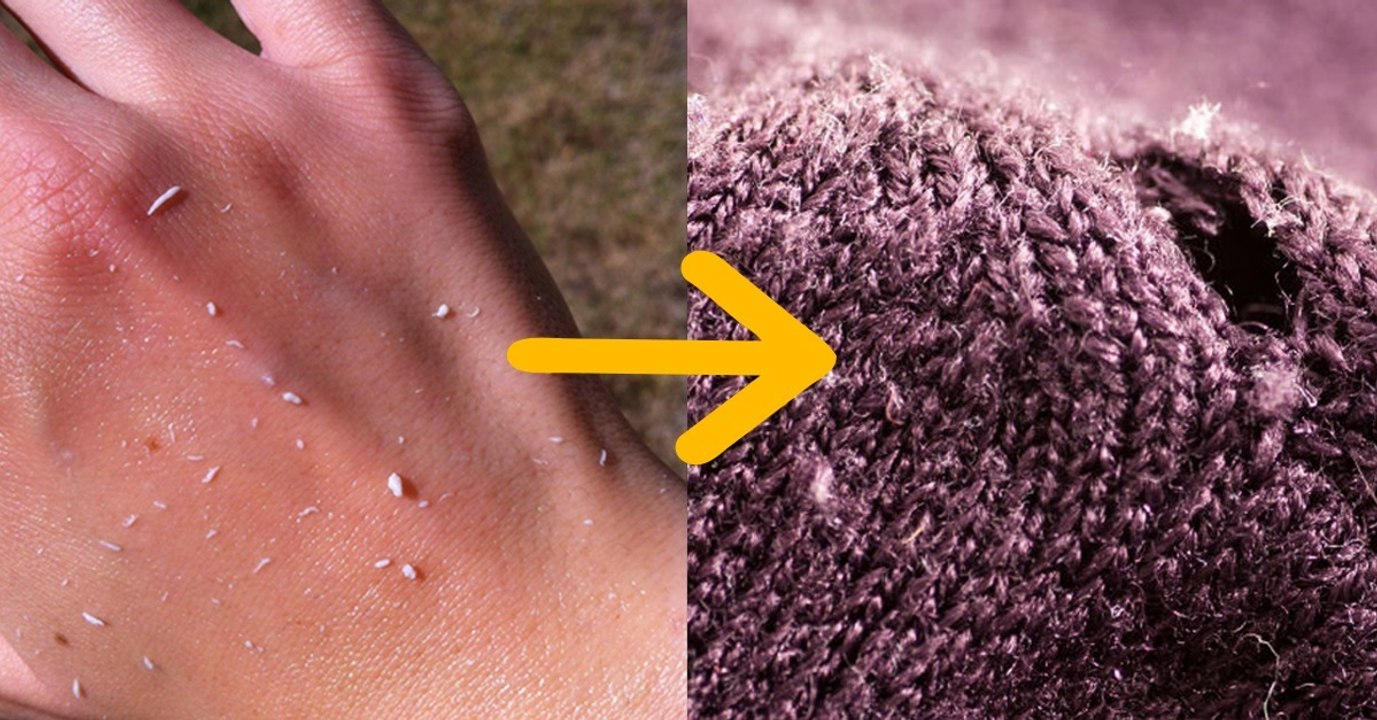 L'astuce pour éviter la peau et les crèmes qui pèlent en plein hiver