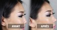 Nose Lifter : le gadget venu d'asie qui modifie la forme du nez sans chirurgie esthétique