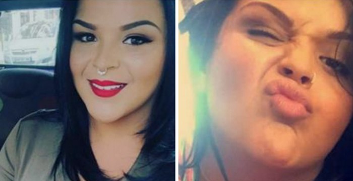 Sarah Fraisou filme ses injections dans les lèvres en direct sur son snapchat !