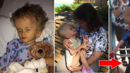 Atteint d'hydrocéphalie, cet enfant a été lâchement abandonné... 5 ans plus tard, voici ce qu'il est devenu !