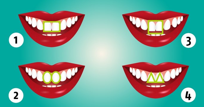 Vous ne devinerez jamais ce que la forme de vos incisives dit de vous !