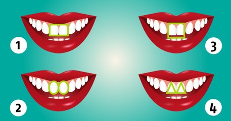 Vous ne devinerez jamais ce que la forme de vos incisives dit de vous !