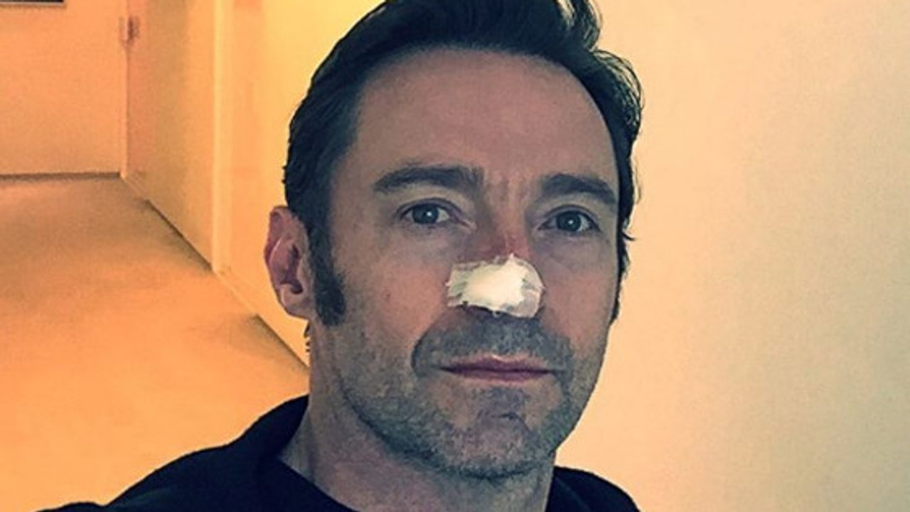 Hugh Jackman : nouveau coup dur pour l'acteur de Wolverine atteint d'un cancer de la peau
