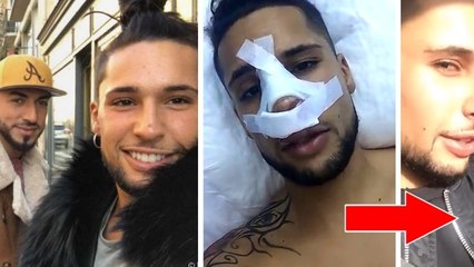 La Villa des coeurs brisés : Eddy dévoile son nouveau nez !