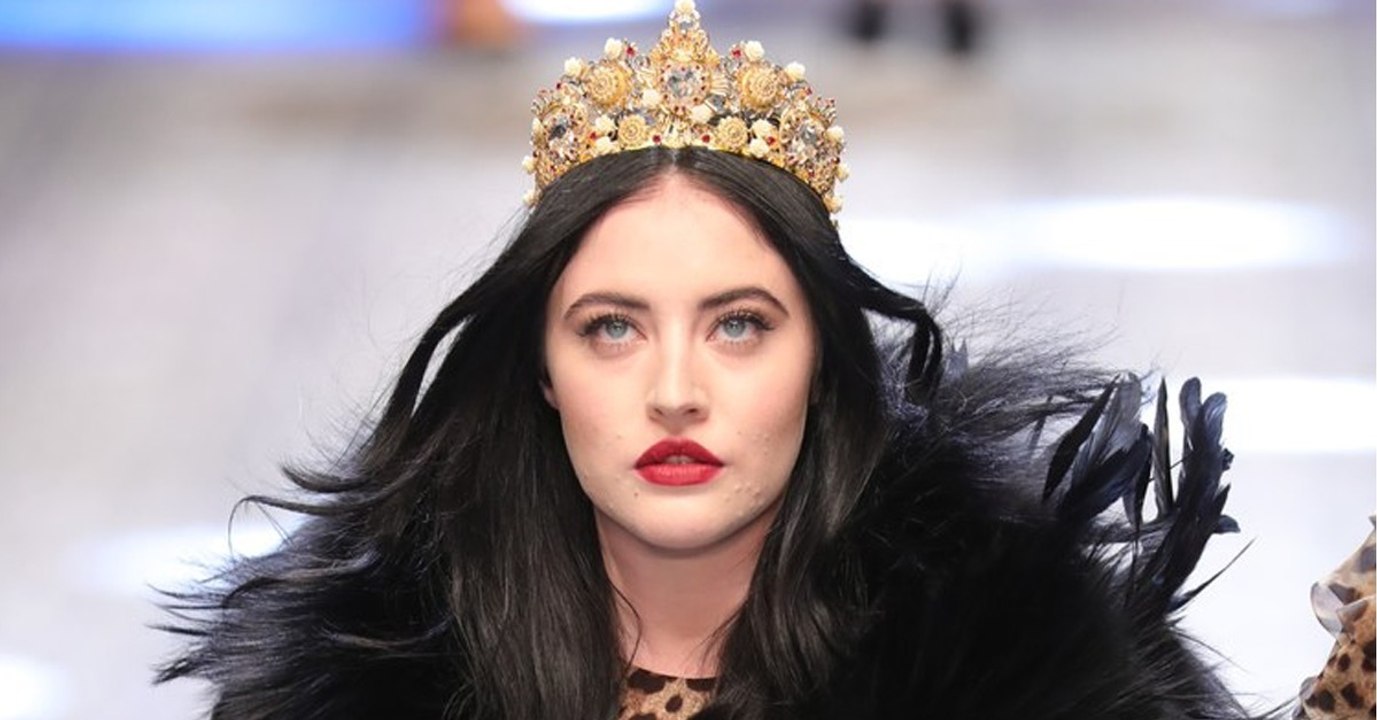 Fashion Week : le mannequin Starlie Smith défile avec de l'acné pour la bonne cause