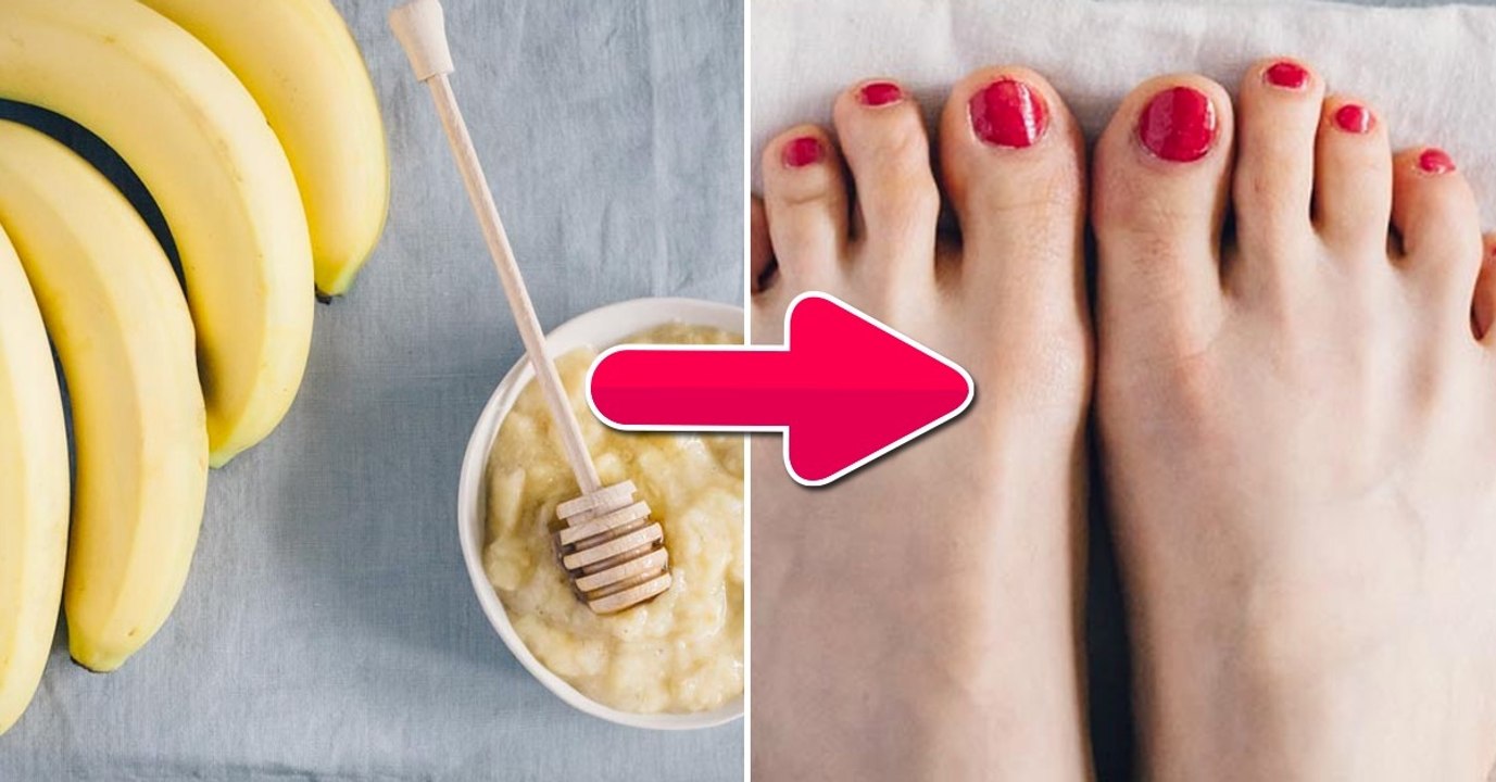 Pieds secs : l'astuce de la peau de banane pour hydrater ses pieds