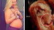 Carissa Gill : enceinte de jumeaux, elle aperçoit quelque chose d'unique à l'échographie