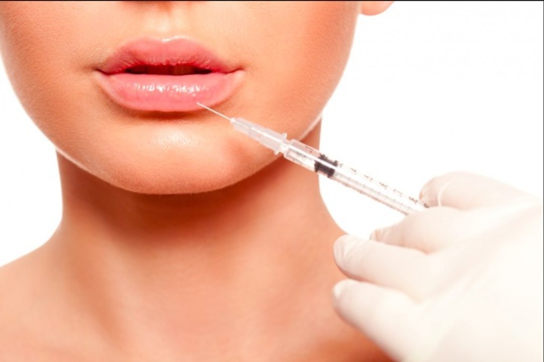 Chirurgie esthétique : une étude scientifique démontre pourquoi les injections des lèvres font très "fake"