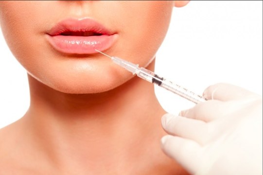 Chirurgie esthétique : une étude scientifique démontre pourquoi les injections des lèvres font très fake