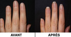 Manucure : le bain miracle pour faire pousser ses ongles plus vite