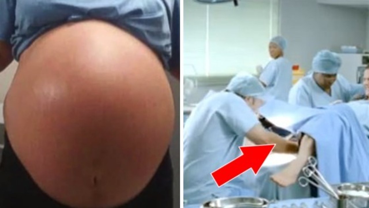 Cette femme accouche d'un bébé d'environ 5.8 kilos